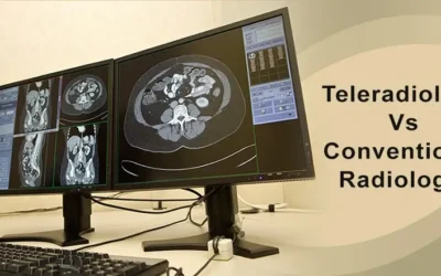 Is Teleradiology Reliable Compared to Conventional Radiology?