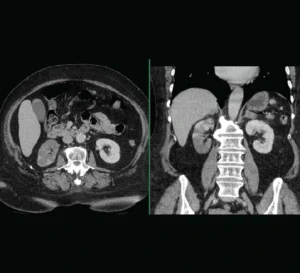 case of the week