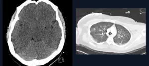 Case of the week